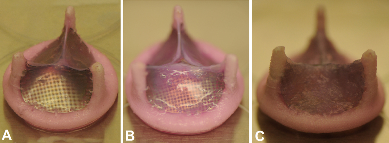 tissue heart valve